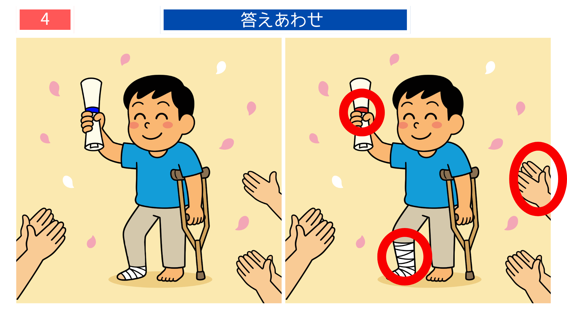 間違い探し無料難しい 包帯や背景が変化した『怪我の功名』の答え画像。観察力アップに役立つ印刷クイズ素材。